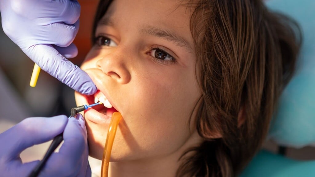 Dental Travma Nedir?