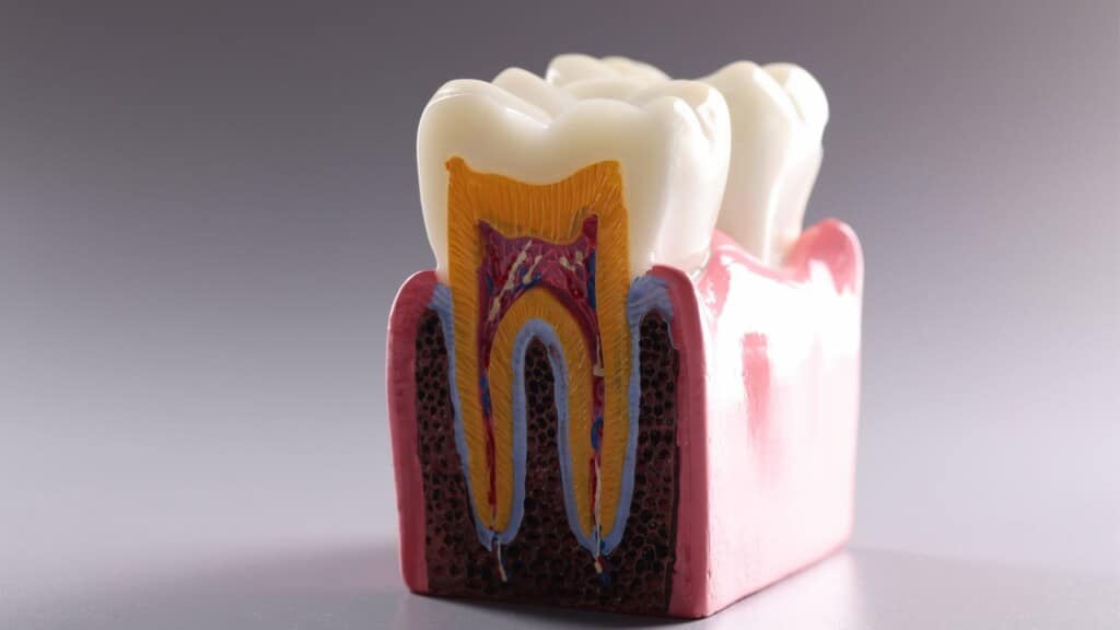 Diş travması nedir