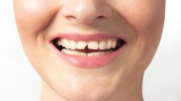 kırık diş ağrısına ne iyi gelir